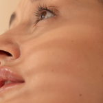 AZELAIČNA KISELINA: nježna ali moćna saveznica za čistu i ujednačenu kožu