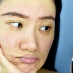 Winter dullness: zašto koža izgleda beživotno zimi i kako vratiti sjaj