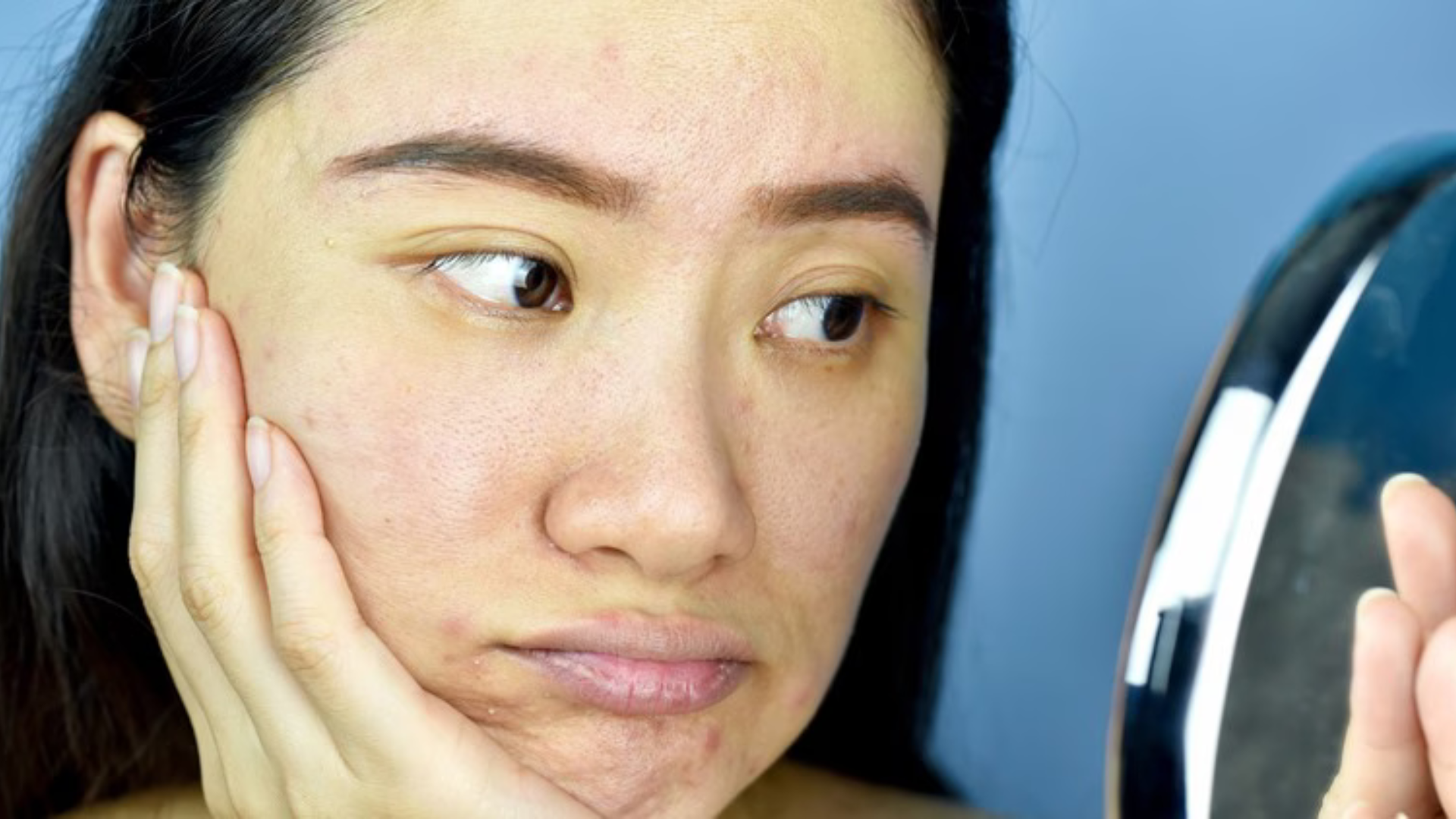 Winter dullness: zašto koža izgleda beživotno zimi i kako vratiti sjaj